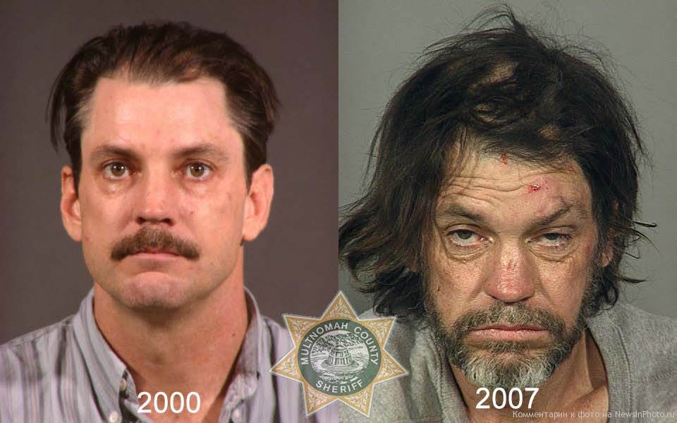 Наркотики фотографии до и после лекарство наркотик